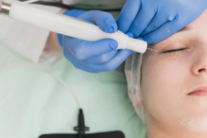 Plasmage_Chirurgie-ohne-OP
